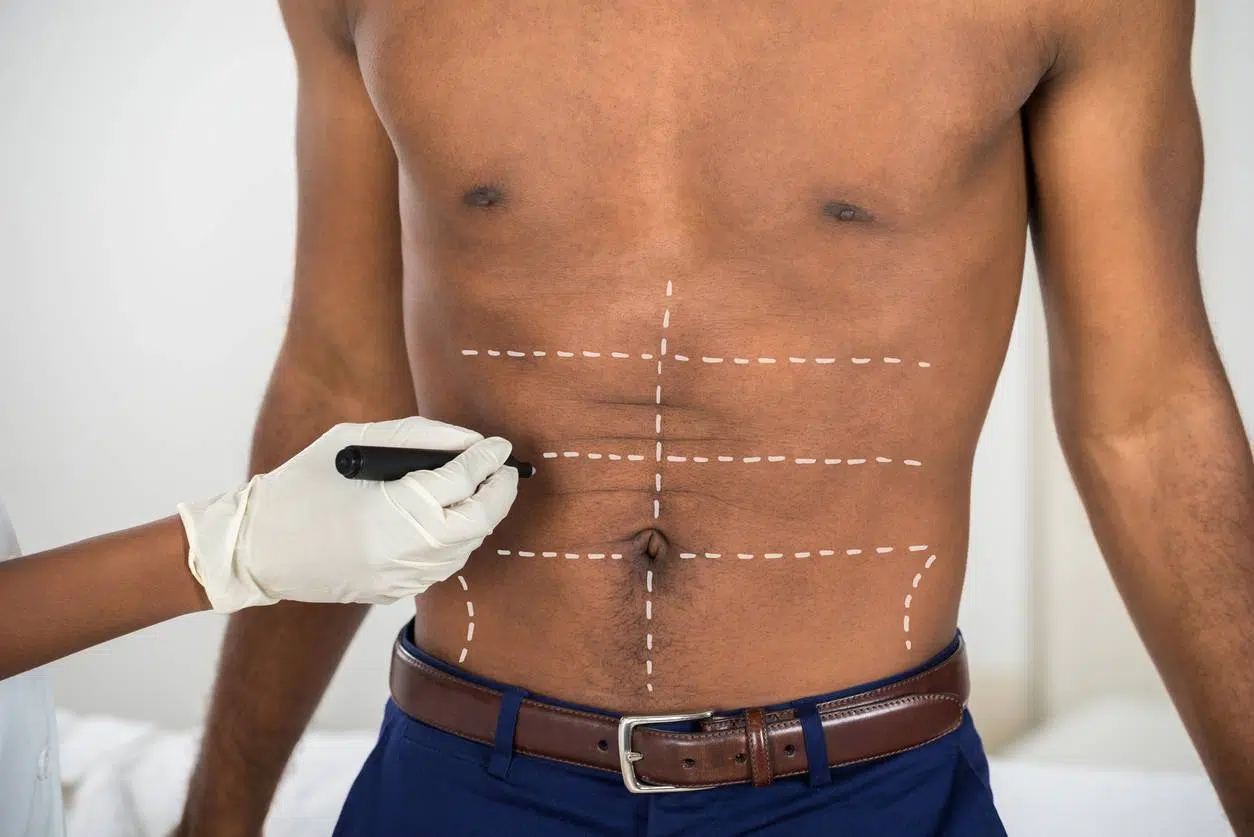chirurgie esthétique homme