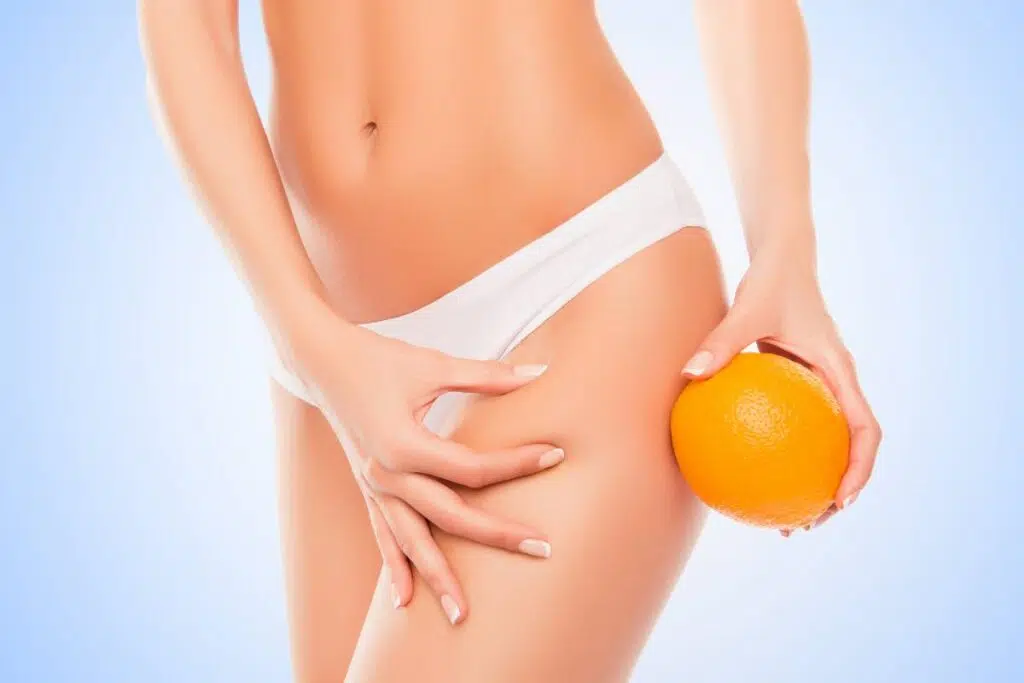 cellulite et peau d'orange