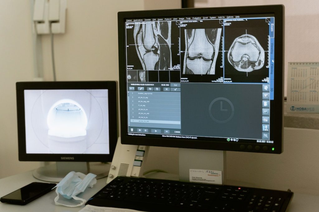 Qu'estce que l'arthroscanner — free download
