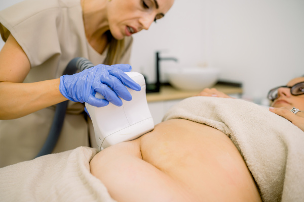 savoir sur Cryolipolyse