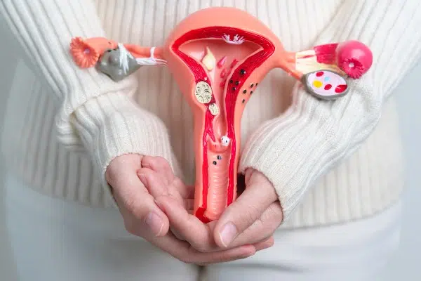 femme avec polype uterin