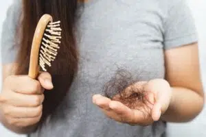 chute de cheveux
