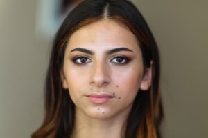 grain de beauté femme